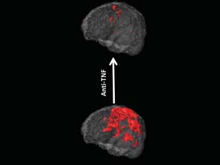 Zum Artikel "Schmerz lass nach"