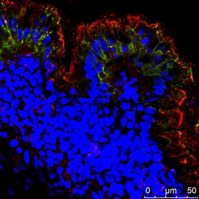 Neues Schlüsselprotein für die Entstehung der chronischen Darmentzündung identifiziert
