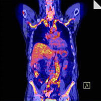Zum Artikel "Fieberauslöser schneller überführt"