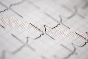 Zum Artikel "Dem Herzen mit „Hightech-Reiskorn“ auf die Sprünge helfen"