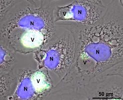 Zum Artikel "Wenn Schafe und Ziegen für Menschen zur Gefahr werden"
