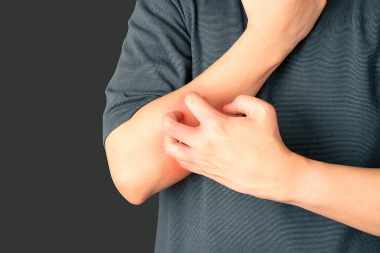 Patientenveranstaltung zu Neurodermitis